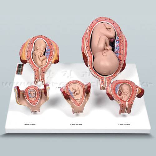 태아 발육과정A형(5종 1조)